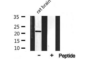 Western blot analysis on rat brain lysate using Musculin Antibody (Musculin 抗体  (Internal Region))