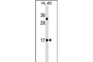 CALCA/CT Antibody ABIN1536608 western blot analysis in HL-60 cell line lysates (35 μg/lane). (Calcitonin 抗体  (AA 104-132))