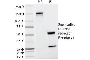 SDS-PAGE Analysis Purified TYRP1 Mouse Monoclonal Antibody (TA99). (Tyrosinase-Related Protein 1 抗体)