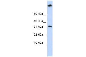 SCP2 antibody used at 1 ug/ml to detect target protein. (SCP2 抗体  (Middle Region))