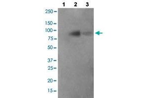 Western blot analysis of Lane 1: antigen-specific peptide treated JK cells, Lane 2: JK cells cells, Lane 3: COS-7 cells with FER (phospho Y402) polyclonal antibody  at 1:500-1:1000 dilution. (FER 抗体  (pTyr402))