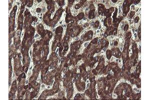 Image no. 6 for anti-Ubiquitin-Conjugating Enzyme E2, J1, U (UBE2J1) antibody (ABIN1501637)