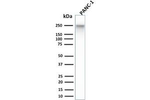 Western Blot Analysis of PANC-1 cell lysate using Spectrin beta III Monoclonal Antibody (SPTBN2/1584). (Spectrin, Beta, Non-erythrocytic 2 (SPTBN2) (AA 356-475) 抗体)