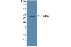 Western blot analysis of recombinant Human Sp100. (SP100 抗体  (AA 610-802))