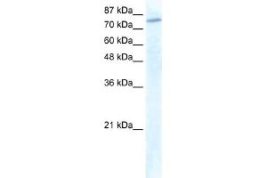 WB Suggested Anti-GTF3C3 Antibody Titration:  1. (GTF3C3 抗体  (N-Term))