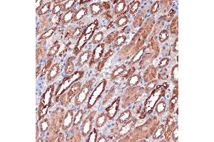 Immunohistochemistry of paraffin-embedded rat kidney using Carbonic Anhydrase 2 (C) Rabbit mAb (ABIN7266070) at dilution of 1:100 (40x lens). (CA2 抗体)