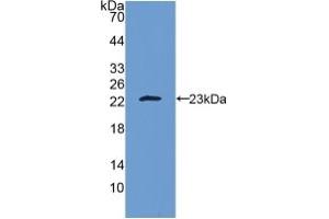 Western blot analysis of recombinant Human IL10. (IL-10 抗体  (AA 19-178))