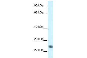 Western Blot showing NDUFS8 antibody used at a concentration of 1 ug/ml against Jurkat Cell Lysate (NDUFS8 抗体  (C-Term))