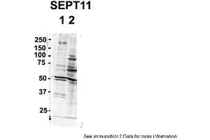 Sample Type: 1. (Septin 11 抗体  (N-Term))
