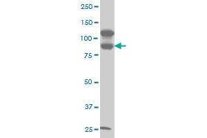 KSR2 monoclonal antibody (M06), clone 5E9 Western Blot analysis of KSR2 expression in A-431 . (KSR2 抗体  (AA 411-500))
