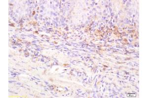 Formalin-fixed and paraffin embedded rat tongue labeled with Anti-IL-20R alpha/IL20RA Polyclonal Antibody, Unconjugated (ABIN748103) at 1:200 followed by conjugation to the secondary antibody (IL20RA 抗体  (AA 135-171))