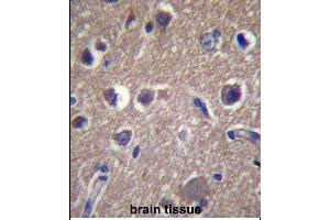 Immunohistochemistry (Paraffin-embedded Sections) (IHC (p)) image for anti-Ankyrin Repeat and Sterile alpha Motif Domain Containing 1B (ANKS1B) (AA 570-599) antibody (ABIN657360)