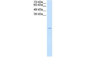 Western Blotting (WB) image for anti-Superoxide Dismutase 1, Soluble (SOD1) (N-Term) antibody (ABIN2782351)