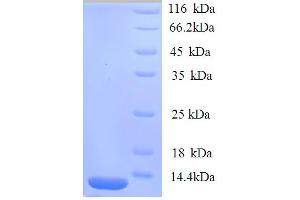 Trefoil Factor 1 (TFF1) (AA 25-84) protein (His tag)