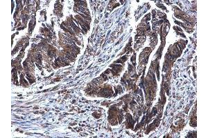 Immunohistochemistry (IHC) image for anti-Succinate Dehydrogenase Complex, Subunit B, Iron Sulfur (Ip) (SDHB) (C-Term) antibody (ABIN2855873)