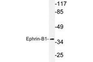 Western blot analysis of Ephrin-B1 antibody in extracts from COS7 cells. (Ephrin B1 抗体)