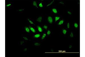 Immunofluorescence of monoclonal antibody to GPR135 on MCF-7 cell. (GPR135 抗体  (AA 391-493))