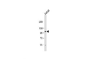 Western Blot at 1:1000 dilution + Jurkat whole cell lysate Lysates/proteins at 20 ug per lane. (Unc5c 抗体  (N-Term))