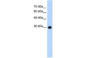 WB Suggested Anti-GABRG2 Antibody Titration:  1. (GABRG2 抗体  (C-Term))