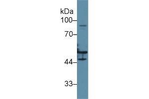 Western blot analysis of Human HeLa cell lysate, using Human KRT16 Antibody (2 µg/ml) and HRP-conjugated Goat Anti-Rabbit antibody ( (KRT16 抗体  (AA 117-419))