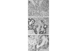 Immunohistochemistry of formalin-fixed paraffin-embedded human pancreas tissue sections. (BAG3 抗体)