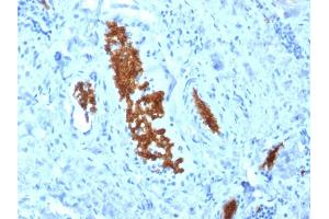 Immunohistochemistry (IHC) image for anti-Spectrin alpha 1, Erythrocytic (SPTA1) (AA 356-475) antibody (ABIN6940643)