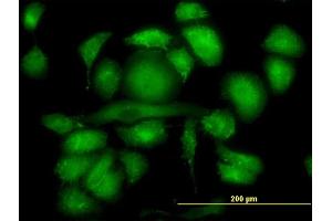 Immunofluorescence of monoclonal antibody to RDX on HeLa cell. (Radixin 抗体  (AA 1-583))