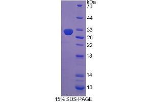 SDS-PAGE analysis of Rat COL9a1 Protein. (COL9A1 蛋白)