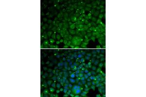 Immunofluorescence analysis of HeLa cell using CRYAA antibody. (CRYAA 抗体)