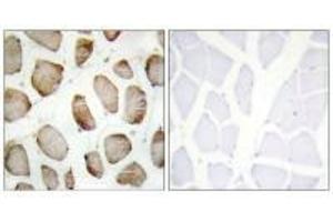Immunohistochemistry analysis of paraffin-embedded human skeletal muscle using DUS2L antibody. (DUSL2 抗体  (C-Term))