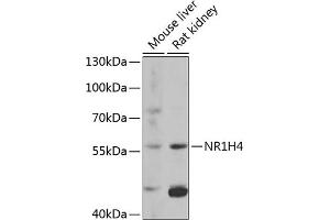 Western blot analysis of extracts of various cell lines, using NR1H4 antibody (ABIN6127919, ABIN6144801, ABIN6144803 and ABIN6216539) at 1:1000 dilution. (NR1H4 抗体  (AA 207-476))