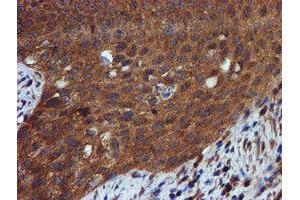 Image no. 11 for anti-Iduronate 2-Sulfatase (IDS) antibody (ABIN1498797)