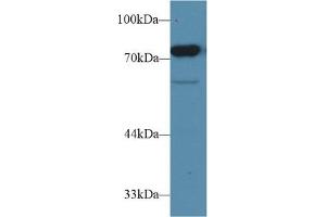 Detection of CD2AP in Rat Testis lysate using Polyclonal Antibody to CD2 Associated Protein (CD2AP)
