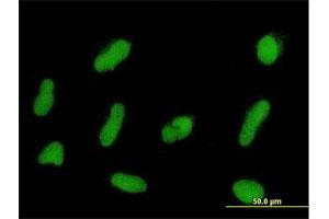 Immunofluorescence of purified MaxPab antibody to ZNF254 on HepG2 cell. (ZNF254 抗体  (AA 1-659))