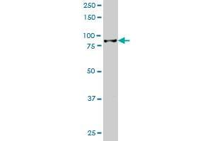 HIC1 monoclonal antibody (M02), clone 2F9 Western Blot analysis of HIC1 expression in Jurkat . (HIC1 抗体  (AA 396-453))