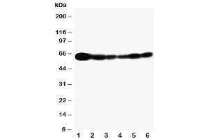 Western blot testing of SHC antibody and Lane 1:  rat brain