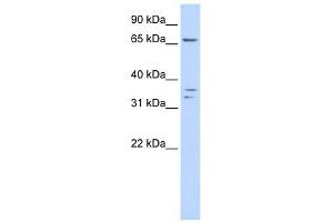 IQCE antibody used at 1 ug/ml to detect target protein. (IQCE 抗体  (Middle Region))