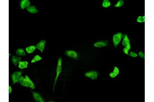 Immunofluorescence of monoclonal antibody to PHGDH on HeLa cell.