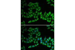 Immunofluorescence analysis of U2OS cells using TPMT antibody (ABIN5970397). (TPMT 抗体)