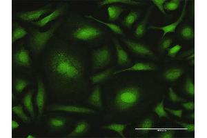 Immunofluorescence of purified MaxPab antibody to CALML6 on HeLa cell. (CALML6 抗体  (AA 1-181))