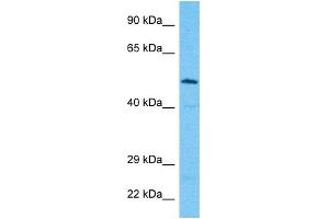 Host:  Rabbit  Target Name:  ALG9  Sample Type:  Jurkat Whole Cell lysates  Antibody Dilution:  1. (ALG9 抗体  (Middle Region))