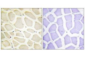 Immunohistochemistry (IHC) image for anti-Collagen, Type X, alpha 1 (COL10A1) (C-Term) antibody (ABIN1850314)