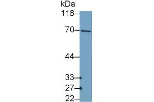 Detection of COL10 in MCF7 cell lysate using Polyclonal Antibody to Collagen Type X (COL10) (COL10 抗体  (AA 547-680))