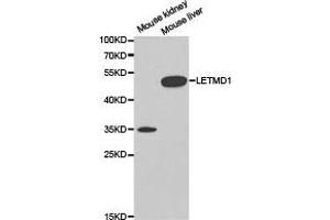 Western Blotting (WB) image for anti-LETM1 Domain Containing 1 (LETMD1) antibody (ABIN1873537) (LETMD1 抗体)