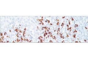Image no. 1 for Rabbit anti-Human IgD (Chain delta) antibody (ABIN952831) (兔 anti-人 IgD (Chain delta) Antibody)