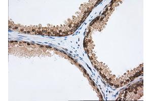 Immunohistochemical staining of paraffin-embedded Human Kidney tissue using anti-PDE4A mouse monoclonal antibody. (PDE4A 抗体)