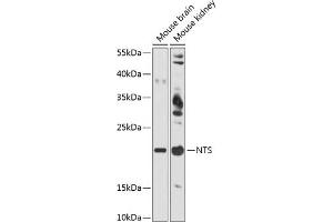 Western blot analysis of extracts of various cell lines, using NTS antibody (ABIN6128380, ABIN6144914, ABIN6144917 and ABIN6215934) at 1:3000 dilution. (Neurotensin 抗体  (AA 24-148))