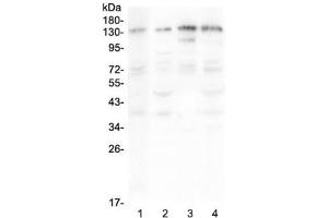 Western blot testing of human 1) A375, 2) HepG2, 3) Jurkat and 4) PANC-1 lysate with EPS15 antibody at 0. (EPS15 抗体)