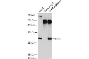 Immunoprecipitation analysis of 300 μg extracts of K-562 cells using 3 μg StAR antibody (ABIN3021302, ABIN3021303, ABIN3021304 and ABIN6214574). (STAR 抗体  (AA 64-285))