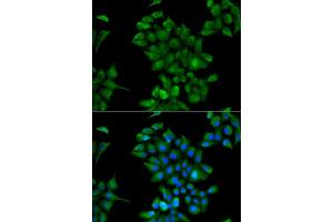 Immunofluorescence analysis of HeLa cell using CTNS antibody. (CTNS 抗体)